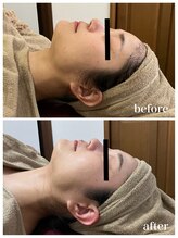 ジャスミン(Jasmin)/バリア機能改善ケア