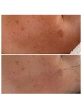 アリュール(Allule)/透明感UP