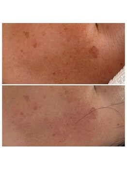 アリュール(Allule)/透明感UP