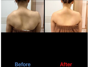 ガネェーシャ(Ganesha)/ガチガチ肩こり解消