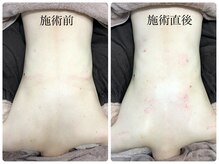 シェミー(CHEZ MEE)/【美ボディ】背中の引き締め