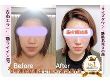 ゴールドハンド 溝の口店(Gold Hand)の雰囲気（◎結果出し満足度8年連1位♪カスタマイズ痩身サイズタウンや小顔）
