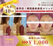 ミライ小顔 上前津店(MIRAI小顔)