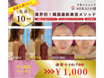 ミライ小顔 上前津店(MIRAI小顔)