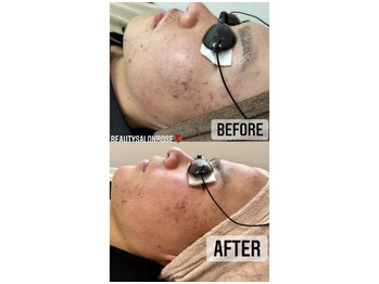 ローズ(Rose)/ハイドロ