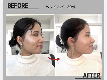 ネムリビト/肩凝り/20代