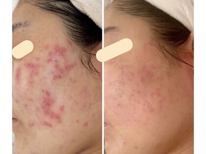 エスポワール(espoir)の写真