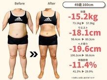 ニドム/49歳　-15kg痩身ダイエット1