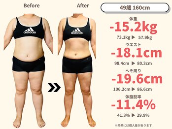 ニドム/49歳　-15kg痩身ダイエット1