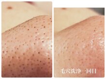 ルル 北仙台の雰囲気(当店大人気!毛穴洗浄◎一回の施術で古い角栓がゴッソリ!!)