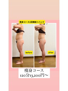 ハピネス(Hapiness)/オーダー痩身コース120分13200～