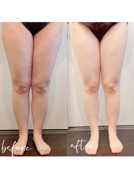 ルシェリアノーブル(le cherien noble)/