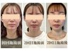 当店一番人気！【エラ張り】Creamの得意技！垢抜けたい方へ☆