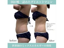 エステティック レイビス 八戸店(RAYVIS)/結果重視☆痩身コース