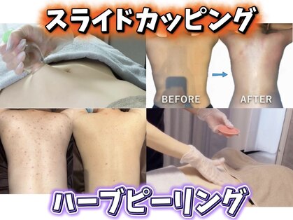 ジュエリーボディー(Jewelry body)の写真