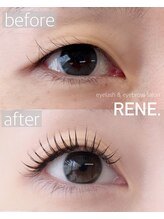 レネ(RENE.)/お目元パッチリ！まつエク