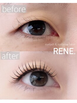 レネ(RENE.)/お目元パッチリ!まつエク