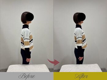 リン 大宮院(RIN)/骨膜整体での変化（担当：舘）