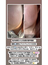 ルクール(Le Coeur)/人気！フォト光フェイシャル♪