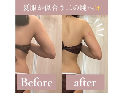 スリラ(SuriLa)の写真