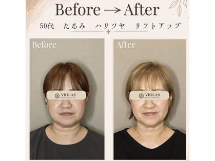 ビオラス(VIOLAS)の写真