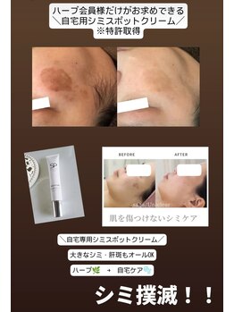 ユニクリア 佐賀(Uniclear)の写真/大人肌の【ハーブピーリング】美白・シミ・肌土台ケア・透明感・ハリ◆光フォトIPL/RF照射◆グルタチオン