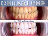 【2回目以降】お得なホワイトニング15回コース