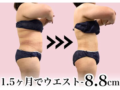 リストアミー(Restore me)の写真