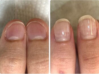 クルル(curule)の写真/自爪ケアも怠らないサロン"クルル"！ネイルのことを熟知しているからこそほぼすべてのクーポンがケア込み♪