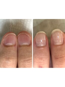 爪の悩みを解消できる（ケア含む）