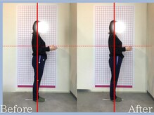 トロ整骨院(toro整骨院)/骨盤矯正★1回の効果★30代女性