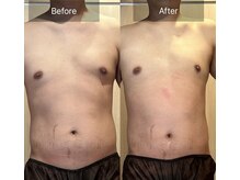 アリッチ 岡崎店(a.Rich)/