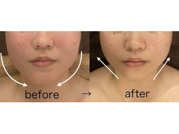 プール エドボリ(POOL EDOBORI)/小顔コルギでエラ張り改善◎