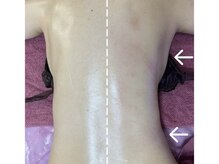 GRACETHOUSAND(グレイスサウザンド)/痩身エステ