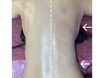 GRACETHOUSAND(グレイスサウザンド)/痩身エステ