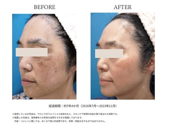 リセラ エン イズモ(recella en izumo)/ビフォーアフター