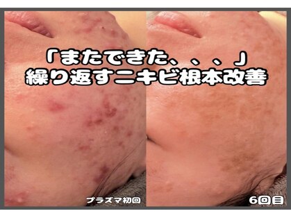 ダリア(Dahlia)の写真