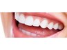歯のセルフホワイトニング　15分１set