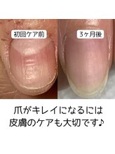 カンパニュラ(Campanula)/手荒れも改善！自爪育成