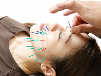 ハリトト鍼灸院の写真/肌ケア美容鍼で若々しい見た目へ♪フェイスラインがスッキリ!むくみ・エラ張り・食いしばり・肌質改善に◎