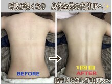 アルページュ(Arpege)/詰まりで埋もれた背中を美ライン
