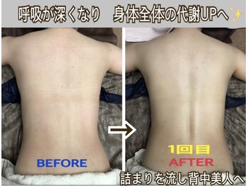 アルページュ(Arpege)/詰まりで埋もれた背中を美ライン