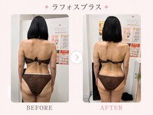パールプラス 会津若松店/肩こり/腰痛/姿勢/巻肩改善