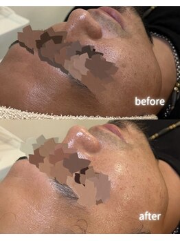 リルビー(Lilby)の写真/メンズの肌質改善もお任せください!