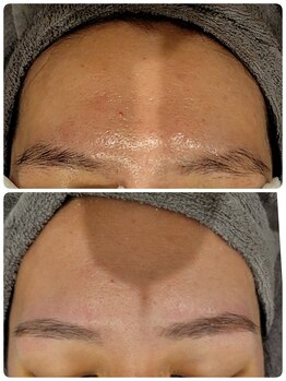 ラピスビリーブ 本店(Lapis believe)/眉リフト