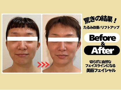 美筋フェイシャル専門サロン カイオナ(KAIONA)の写真