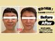 美筋フェイシャル専門サロン カイオナ(KAIONA)の写真