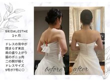 アモリール(Amolir)/ブライダル痩身6回　k様