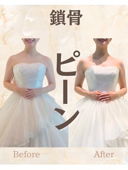 クレール整体院/鎖骨が綺麗に出ています♪/