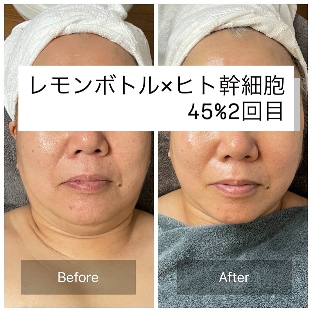 防府市でEMSが人気のエステサロン｜ホットペッパービューティー